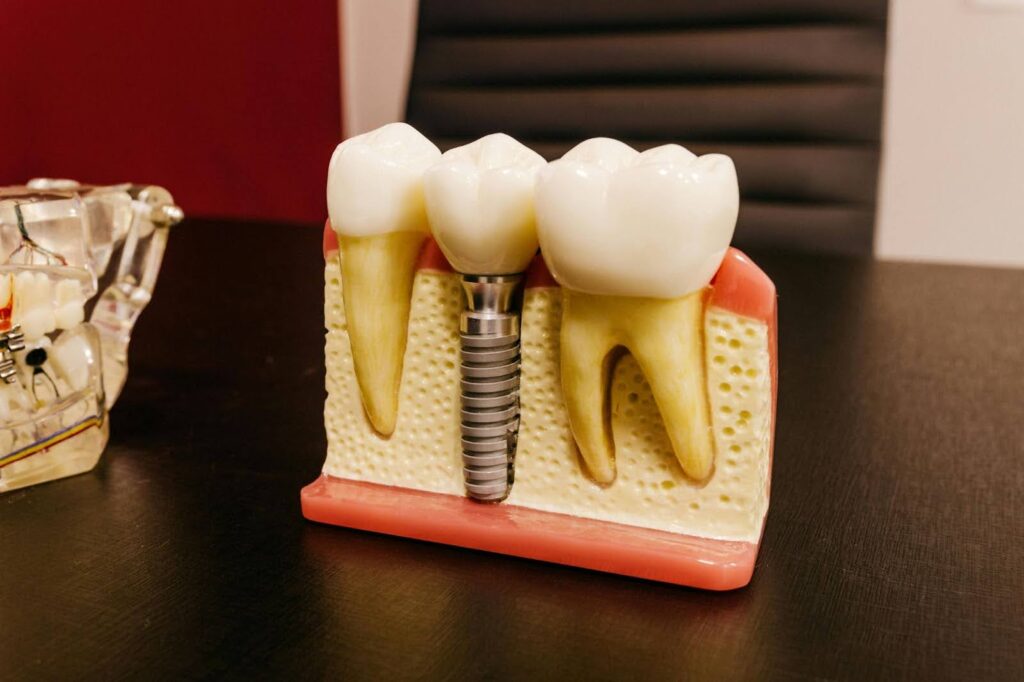 Dantu implantacija Pilėnė - odontologijos klinika